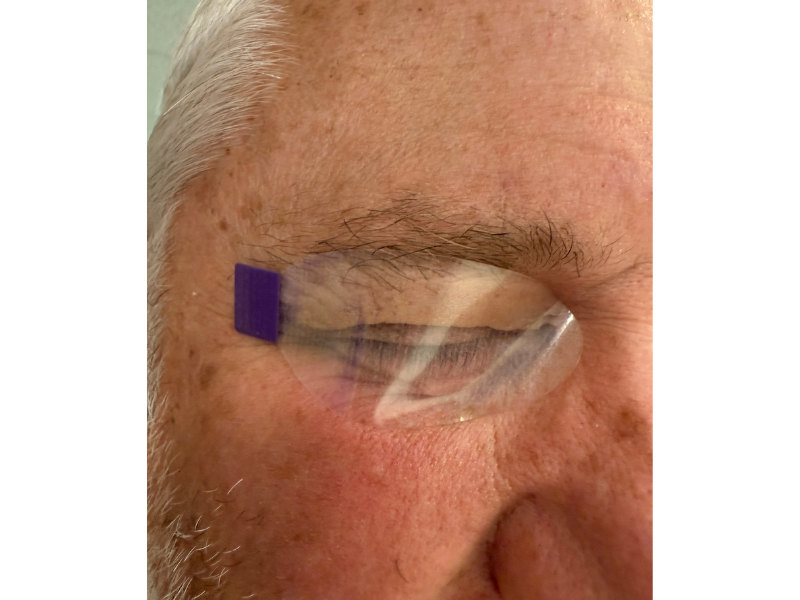 SleepTite/SleepRite - adhesive strips for sealing eyelid – DryEyeShop